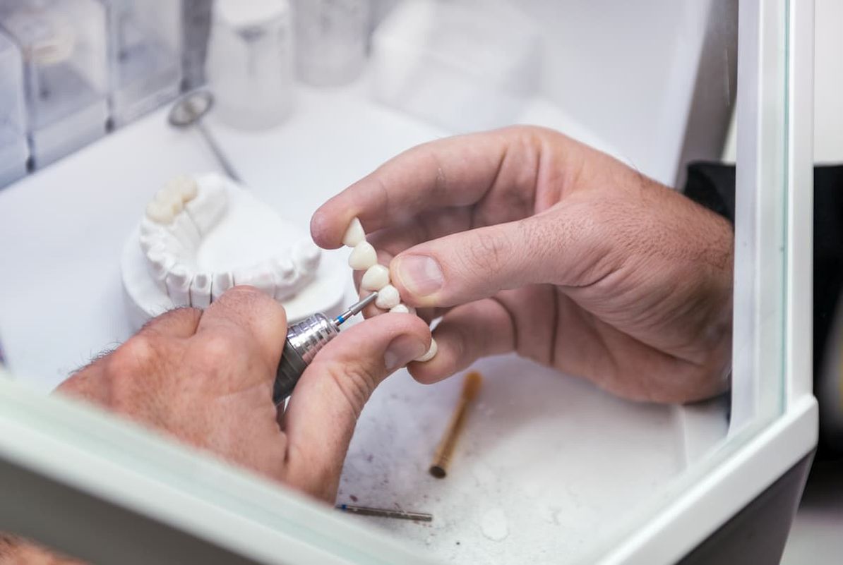 Implantat wird gefertigt